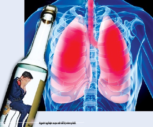 Uống nhiều rượu có thể làm tăng nguy cơ ung thư phổi
